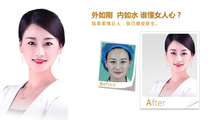 宁德V脸、线雕隆鼻